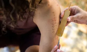 Chi hàng chục nghìn USD cho các liệu pháp sức khỏe cực đoan